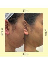 スタイルドアー(style door)/ExoLift