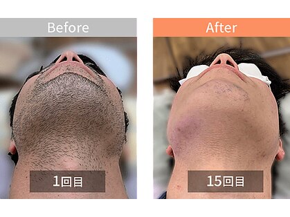 レゾン 池袋店(RESON)の写真