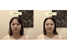 アジール 長岡リバーサイド千秋店(agir)/before/after画像