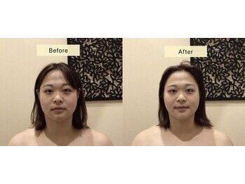 アジール 長岡リバーサイド千秋店(agir)/before/after画像