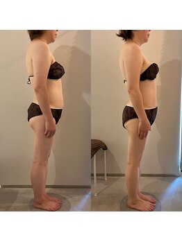 ラナ 京都西院店(Lana)/腕の痺れや背中の重だるさに