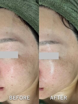 サロンドジェシカ(salon de Jessica)/プラズマ