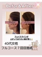 瑞 鍼灸院/瑞‐鍼灸フルコース美容鍼