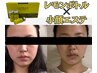 【結果重視】レモンボトル×小顔マッサージ 60分¥9,900