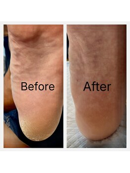 フットファースト 名古屋池下店/ゴルフ好きに大人気！