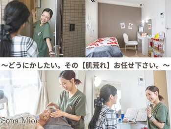 ソナミオール(SonaMior)