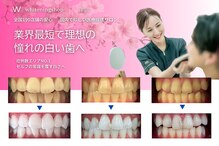 ホワイトニングショップ 津店