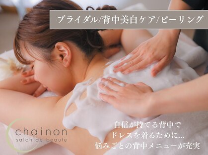 シェノン(chainon)の写真