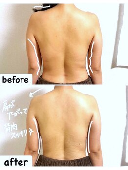 つばききよら/２０代のお客様☆背中スッキリ！