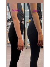 エムイー(ME)/ピラティスで近付く美尻