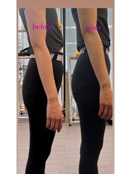 エムイー(ME)/ピラティスで近付く美尻