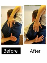 アース エンジェル整体院/【海外の方】ビフォアフ　