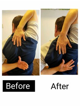 アース エンジェル整体院/【海外の方】ビフォアフ