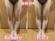 ヨサパーク サーナ(YOSAPARK Sana)の写真