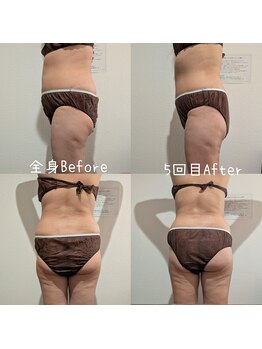 サロン ド モミカル(salon de momikaru)/