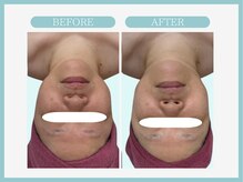 アコガレコガオ 青森店/