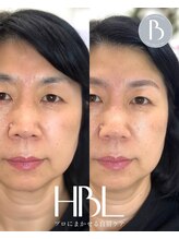 エラ アイブロウサロン(Ella eyebrowsalon)/眉毛wax + HBL