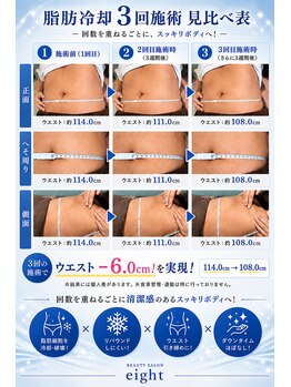 エイト(eight)の写真/[亀有]韓国アイドルのような、洗練されたメリハリBODYラインへ。トレンドの脂肪冷却で、脂肪細胞を撃退◎