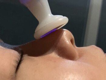 リベルテ(Liberte)の写真/シミ・シワケア、毛穴、くすみ、ニキビケア◎あらゆる肌トラブルにアプローチが可能♪