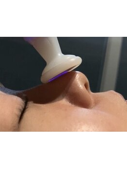 シミしわ改善！予防ケア