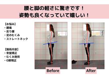 ライト整体院 倉吉(Light整体院)/ついつい足組んでませんか？