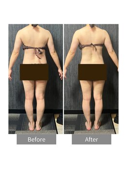 ヒヨリ(hiyori)/《before/after》body