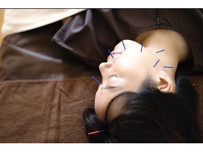 ロノ(Lono)の写真