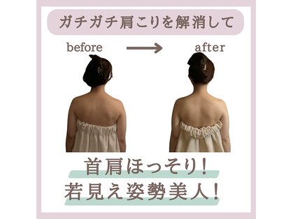 ミトラ(MITRA)の写真