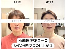 セリア(CELIA)の雰囲気（小顔矯正 /小顔/リンパマッサージ/ドライヘッドスパ/渋谷/表参道）