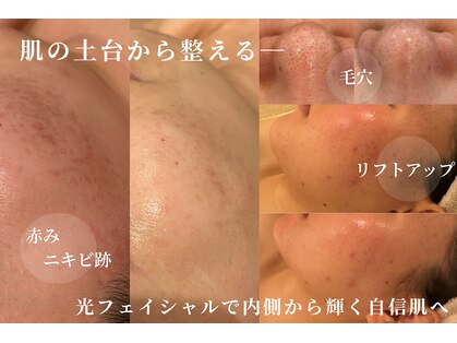 スパレーカ(Spa laka)の写真