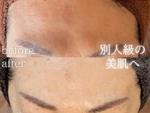 ラヴェリテ(La verite)の雰囲気（リアボーテこだわりの幹細胞ケアで内側からハリのある艶肌が叶う）