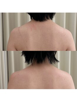 クレン(CLEN)/ブライダルの方おすすめ！コルギ