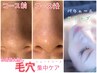 【学割U24】【初回限定】★お着替え無し★8月迄毛穴集中フェースショート40分