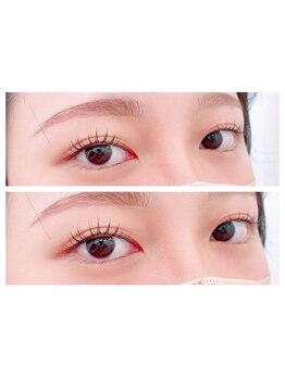 アンカーバイナチュラル アイラッシュ(anchor by natural eyelash)/まつ毛パーマ