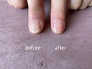 Hand nail care
