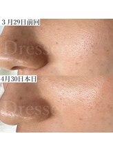 ドレッサー(Dresser)/デパコスでは叶わなかった