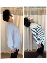 福岡西新整骨院/ビフォーアフター