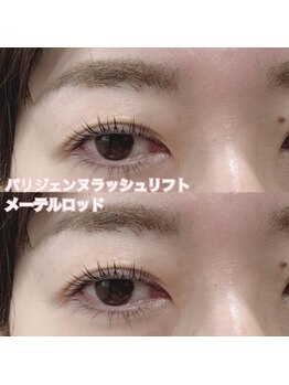 レディエント(Radiant)/パリジェンヌ/メーテルロッド