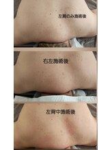 スマイリー(smiley)/