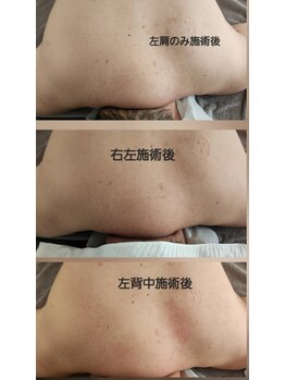 スマイリー(smiley)/