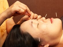 さらのて鍼灸院 高崎院