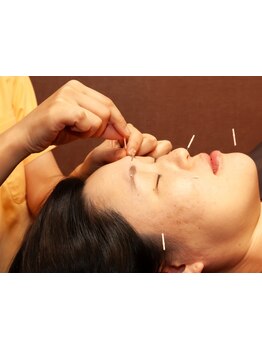 小顔になりたい