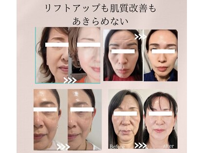 アクシア(Axia)の写真