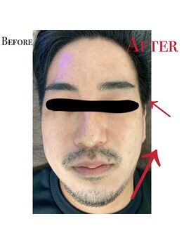 アリッチ 岡崎店(a.Rich)/頭皮ケア☆最新ドライヘッドスパ