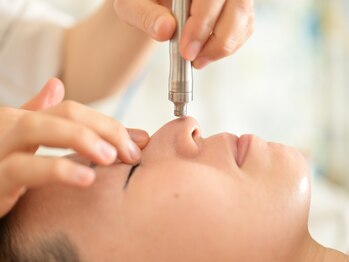 エラフリー/3. ピーリングで角質ケア