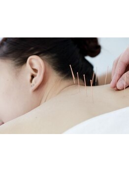 鍼灸施術を受けたい
