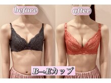 アルビアの雰囲気（3ヶ月で3カップアップした方も★あなたの為のオーダーメイド施術）