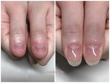 エルナ(elna)の雰囲気（幼い頃から悩んでいた深爪も、しっかりサポートさせて頂きます）