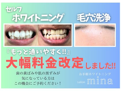ミナ(mina)の写真
