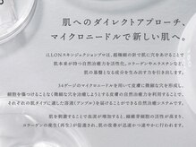 ルヴニール/
